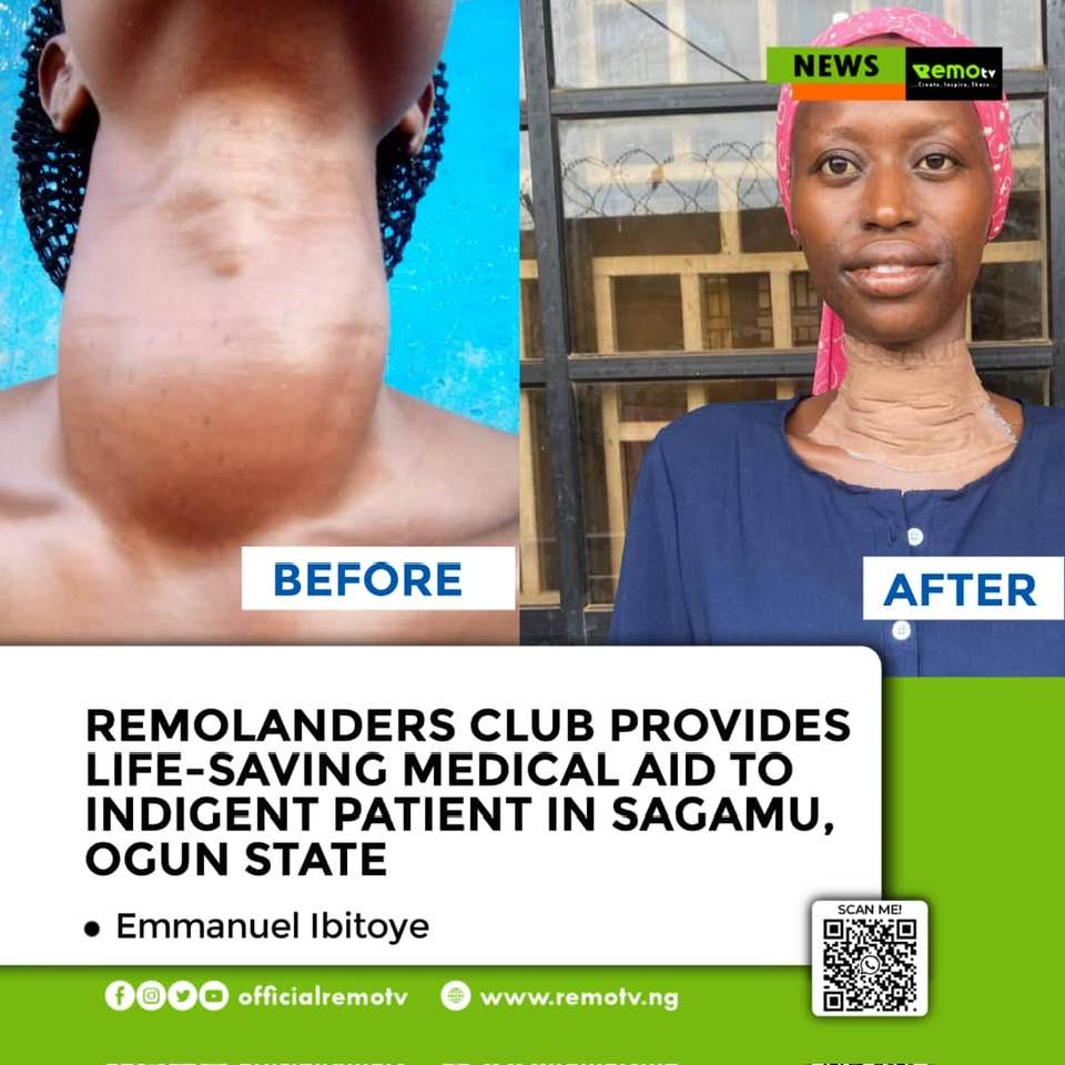 Remolanders Facilitates Life Saving Surgery